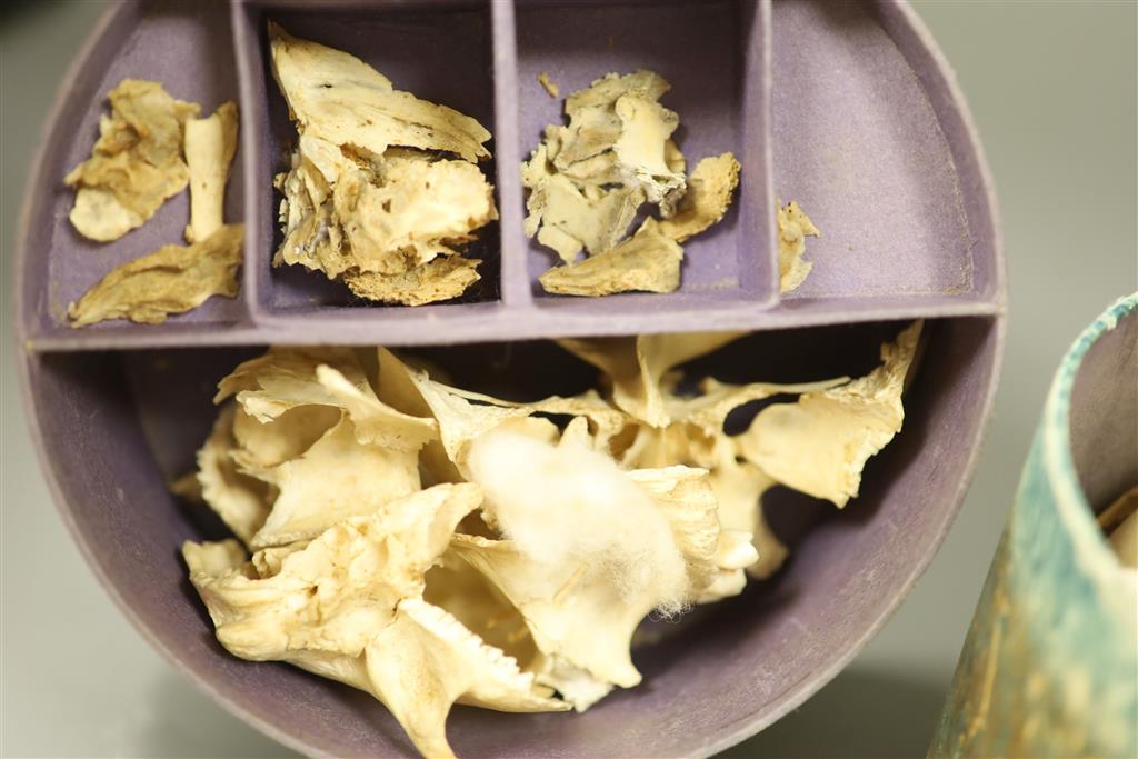 A Victorian disarticulated human skull in original tiered box